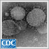 Síndrome respiratorio de Oriente Medio (Middle East Respiratory Syndrome)