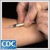 Mantoux Tuberculin Skin Test